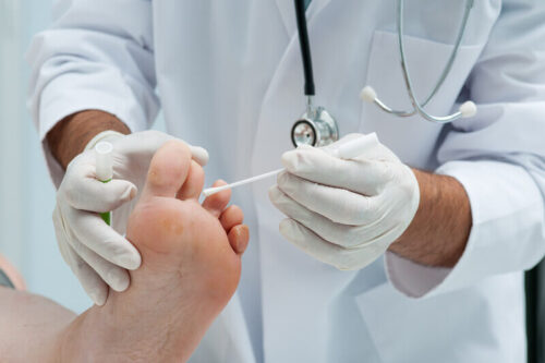 get rid of toenail fungus infection