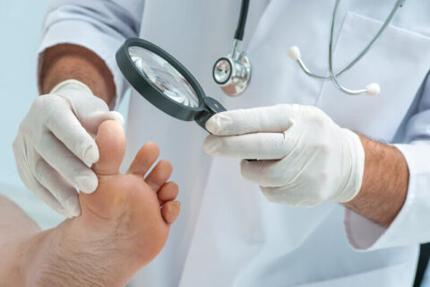 treating toenail fungus infection